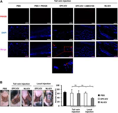 Transformed extracellular vesicles with high angiogenic ability as therapeutics of distal ischemic tissues